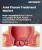 Anal Fissure Treatment Market Size, Share, and Growth Analysis, By Treatment Types (Topical Nitroglycerin, Calcium channel Blockers), By Application (Clinics, Hospitals), By Route of Administration, By Region - Industry Forecast 2025-2032