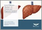 Liver Fibrosis Market - A Global and Regional Analysis: Focus on Country and Region - Analysis and Forecast, 2025-2035