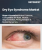 Dry Eye Syndrome Market Size, Share, and Growth Analysis, By Product (Over the Counter Artificial Tears & Lubricants, Prescription Drugs), By Dosage Form, By Distribution Channel, By Region - Industry Forecast 2025-2032