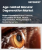 Age-related Macular Degeneration Market Size, Share, and Growth Analysis, By Product (Eylea & Eylea HD, Lucentis), By Molecule, By Approval Type, By Type of AMD, By End User, By Region - Industry Forecast 2026-2033