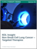 非小细胞肺癌的标靶治疗市场:KOL的洞察