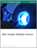 膀胱癌市场:KOL的洞察