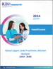 全球上肢义肢市场规模、份额和趋势分析报告：按产品类型、按组件、按最终用户、按地区、展望和预测，2023-2030 年